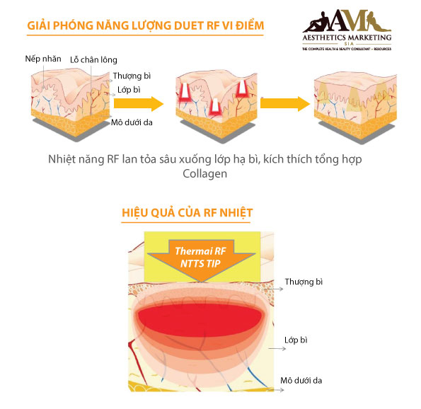 Máy thẩm mỹ THERMA V-line DUET RF